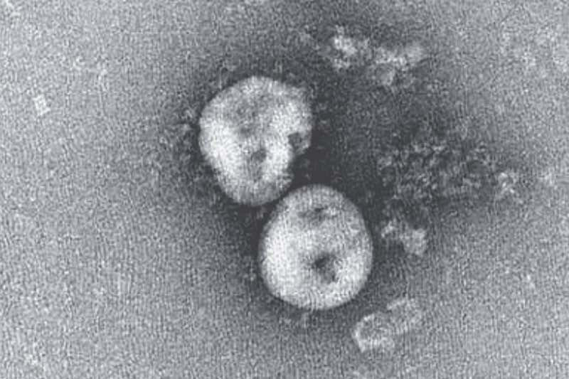 Hình ảnh thực tế của Virus Corona