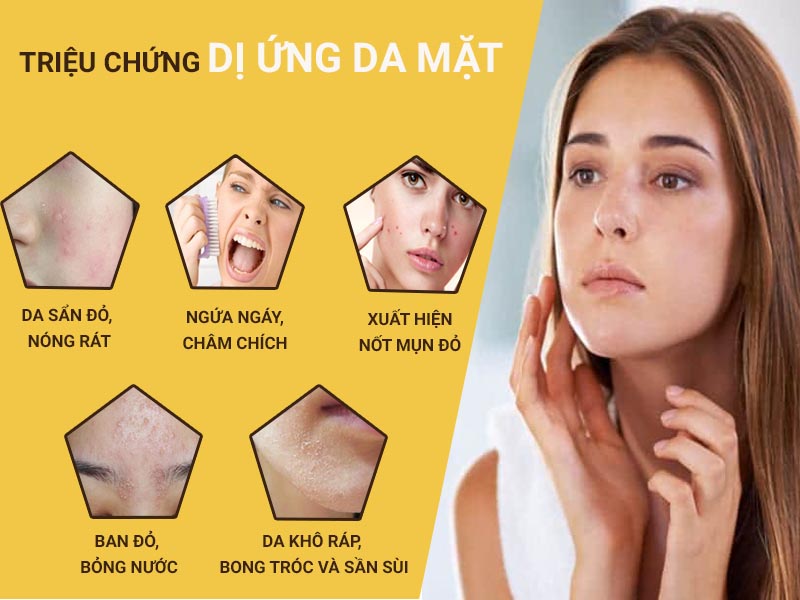 Các dấu hiệu dị ứng da mặt thường gặp