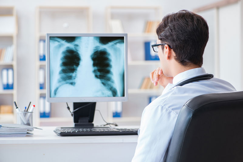 Kết quả X quang tim phổi thường có giá trị cao trong chẩn đoán xác định bệnh.