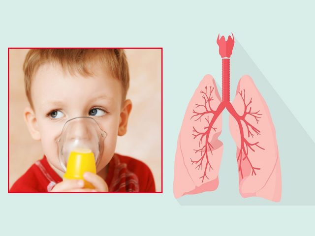 Viêm phế quản phổi ở trẻ em là một tình trạng viêm đường hô hấp dưới mức độ nặng