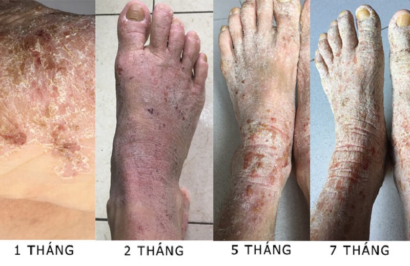 Hình ảnh bệnh nhân Diễm Thu do bác sĩ Bùi Thanh Tùng điều trị trong thời gian rất dài