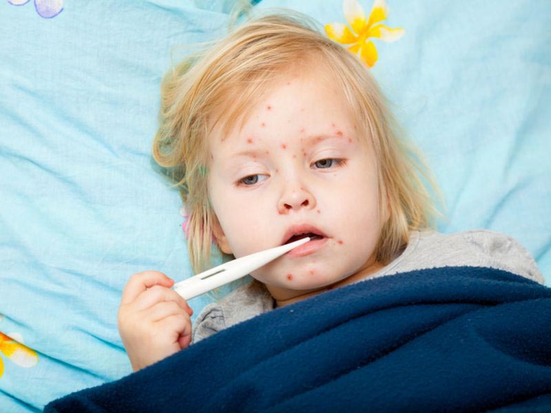 Sốt nổi mẩn đỏ, ngứa là dấu hiệu thường thấy trong một số bệnh nhiễm trùng, nhiễm virus ở trẻ em