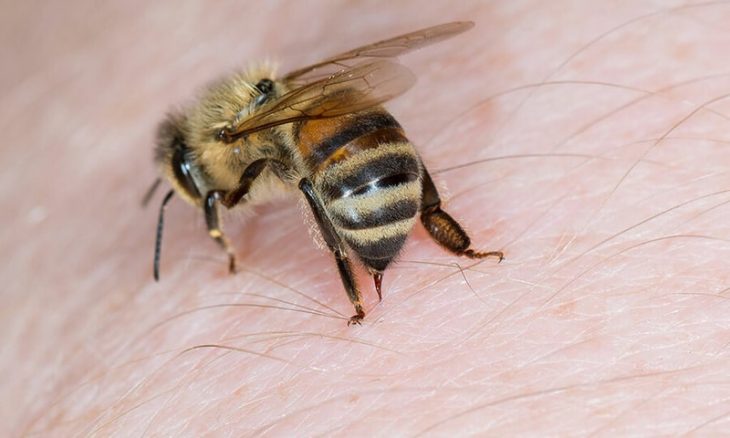 Chữa bệnh xương khớp bằng ong châm được thực hiện bởi nhiều cách