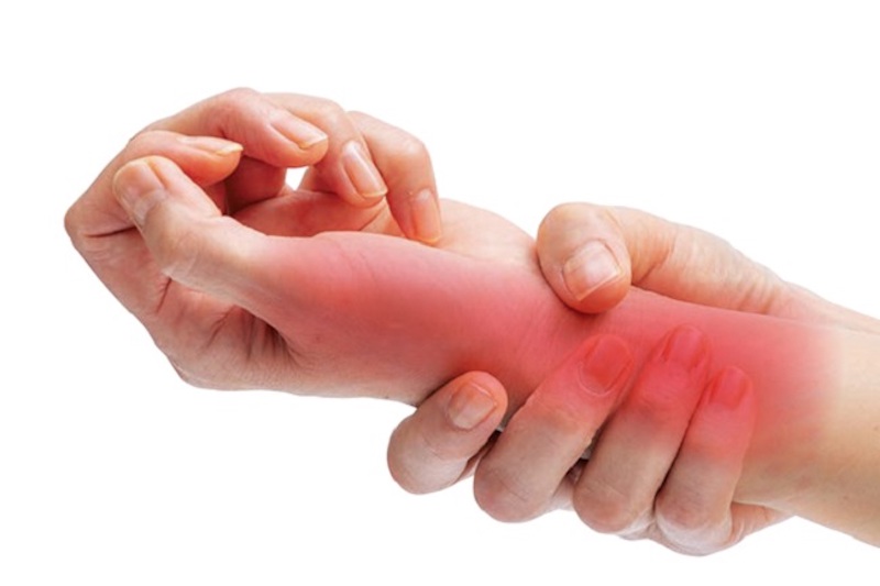 Biểu hiện của bệnh bao gồm đau nhức khớp cổ tay, nóng đỏ khớp,...