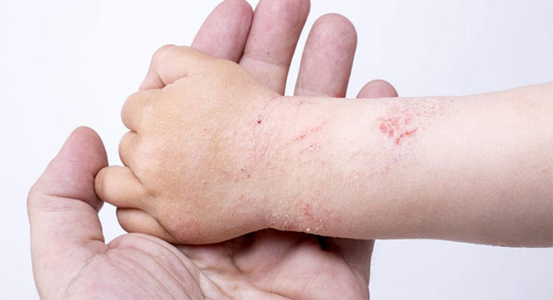 Với trẻ sơ sinh, cha mẹ có thể dùng bao tay bằng vải mềm để tránh những tác động quá mạnh lên da của trẻ. 