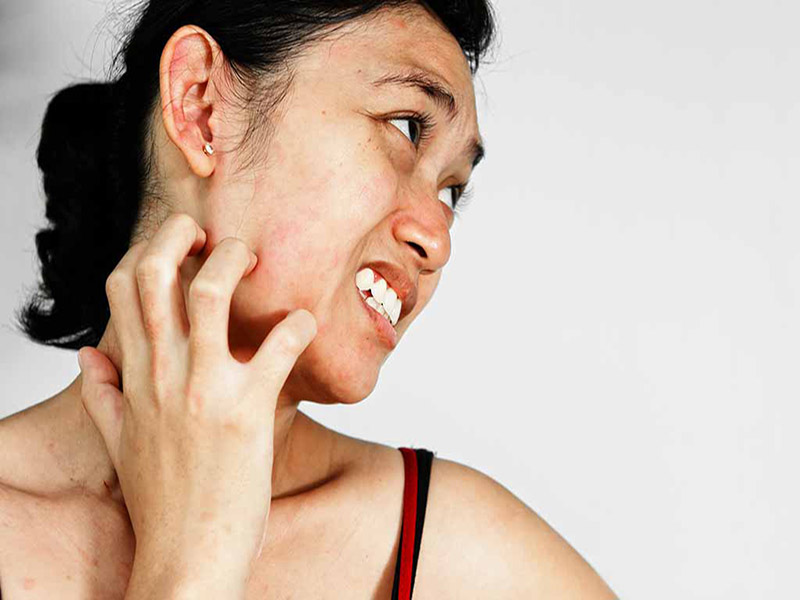 Da mặt bị ngứa do nguyên nhân gì? Cách khắc phục hiệu quả, an toàn