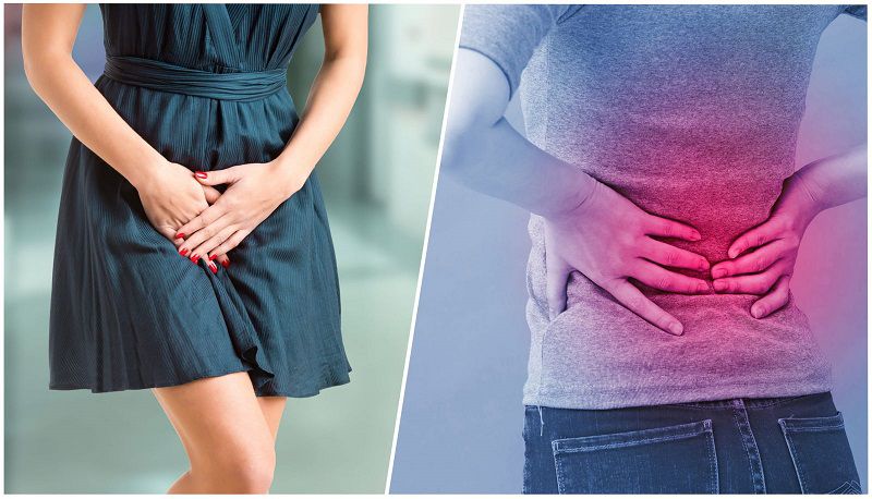 Bệnh này có thể gây đau bụng dưới và cả vùng thắt lưng, xương chậu