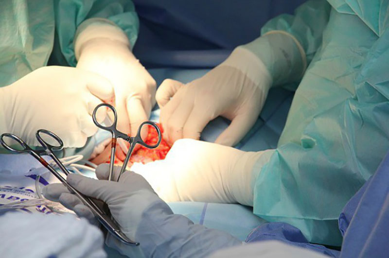 Phẫu thuật sẽ được chỉ định khi điều trị nội khoa không hiệu quả