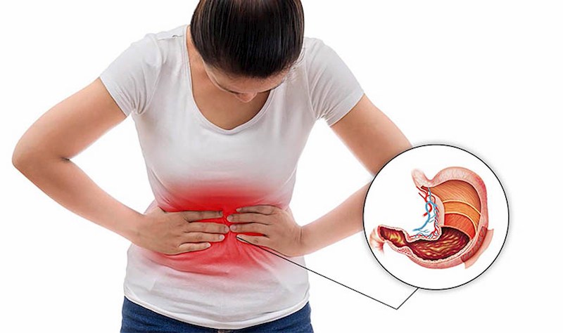 Đau bụng ở rốn nguyên nhân có thể do các bệnh lý về dạ dày, đường ruột gây ra