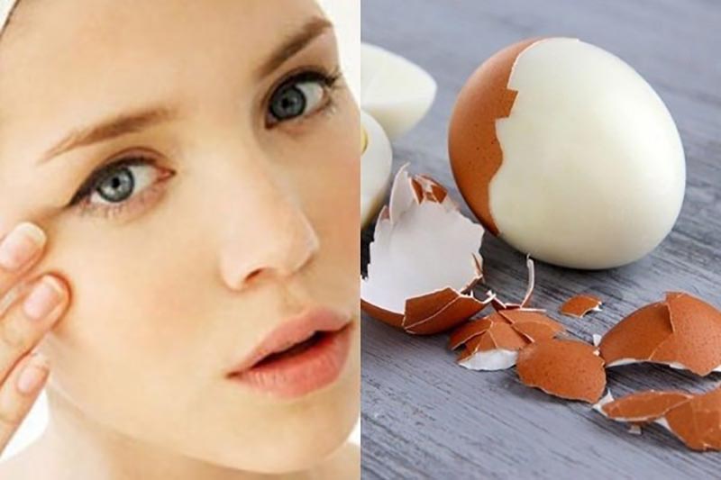 Cách trị thâm mắt bằng trứng gà cần đặc biệt chú ý để không bị bỏng