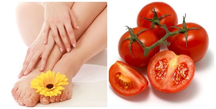 Cà chua là cách trị lông chân tại nhà đơn giản, hiệu quả cao