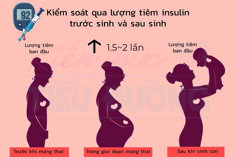 Lượng tiêm insulin sau khi sinh cần trở về mức ban đầu vào thời điểm trước khi mang thai