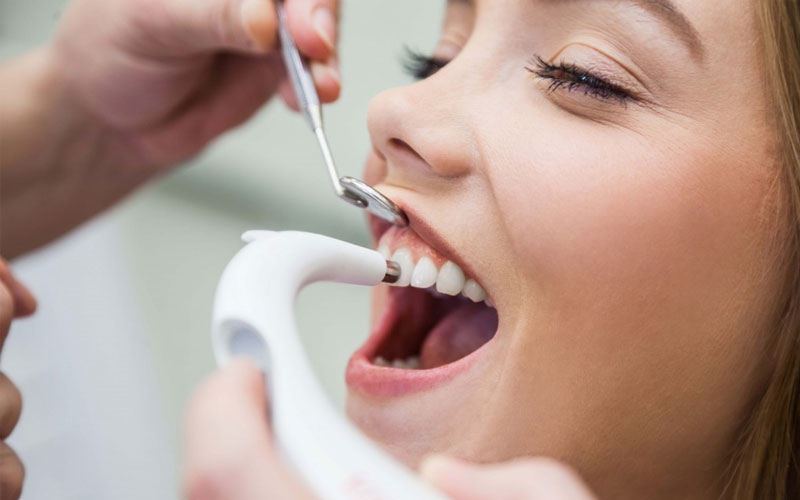 Vệ sinh răng miệng sạch sẽ là một bước quan trọng trong quy trình bọc răng sứ