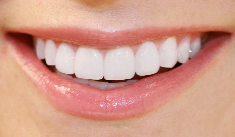 Hình ảnh trước và sau khi bọc răng sứ sẽ có sự khác biệt đáng kinh ngạc