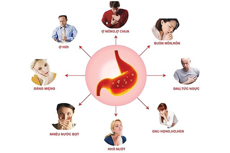Bệnh dạ dày phổ biến tại Việt Nam với một số triệu chứng điển hình