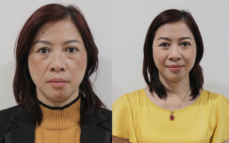 Khách hàng Kim Hoa với làn da trước và sau khi dùng Vương Phi
